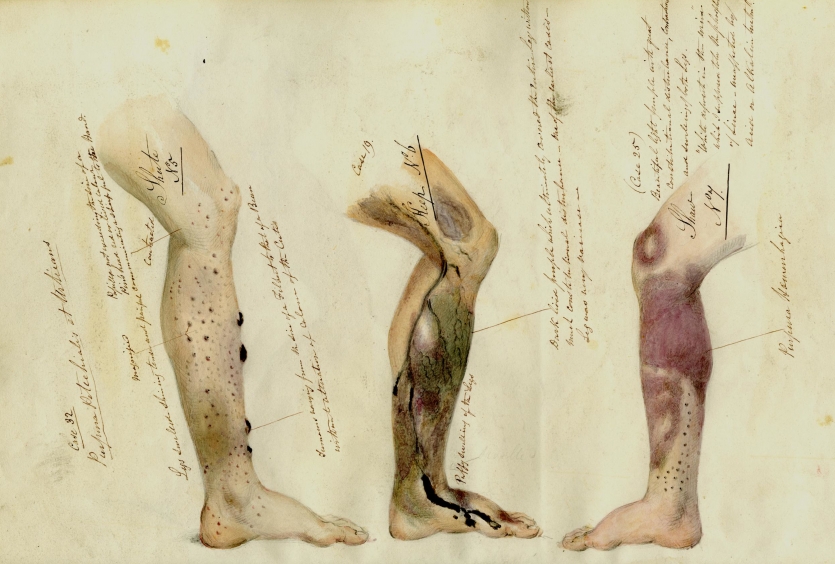 «&nbsp;Hé, pense à prévenir si tu mets des illustrations médicales dégueus Oh, tu m’entends&nbsp;?&nbsp;».