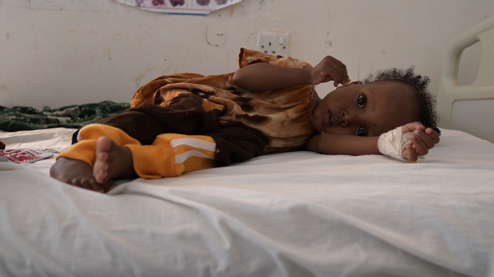 Dans un centre de soin en Somalie qui traite les enfants gravement malnutris. (photo Vakita)