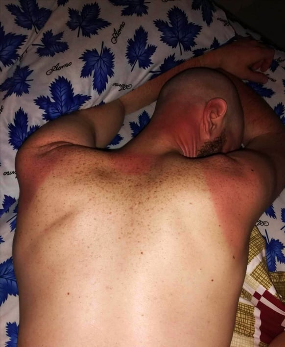 un malabar tout bonnement