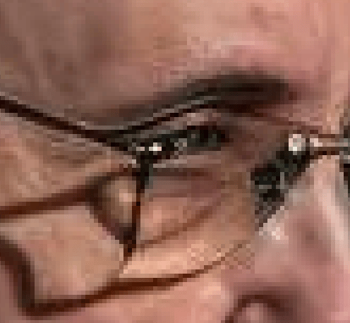 Lunette droite distendue sur le bas