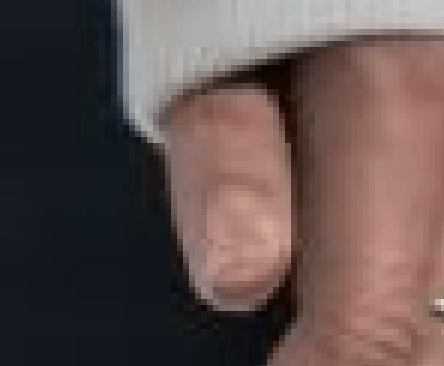 Après le double menton, Midjourney a inventé le double pouce !