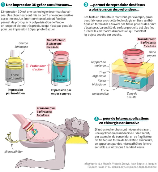 Principe de fonctionnement de l'impression 3D par ultrason pour un usage chez l'Homme