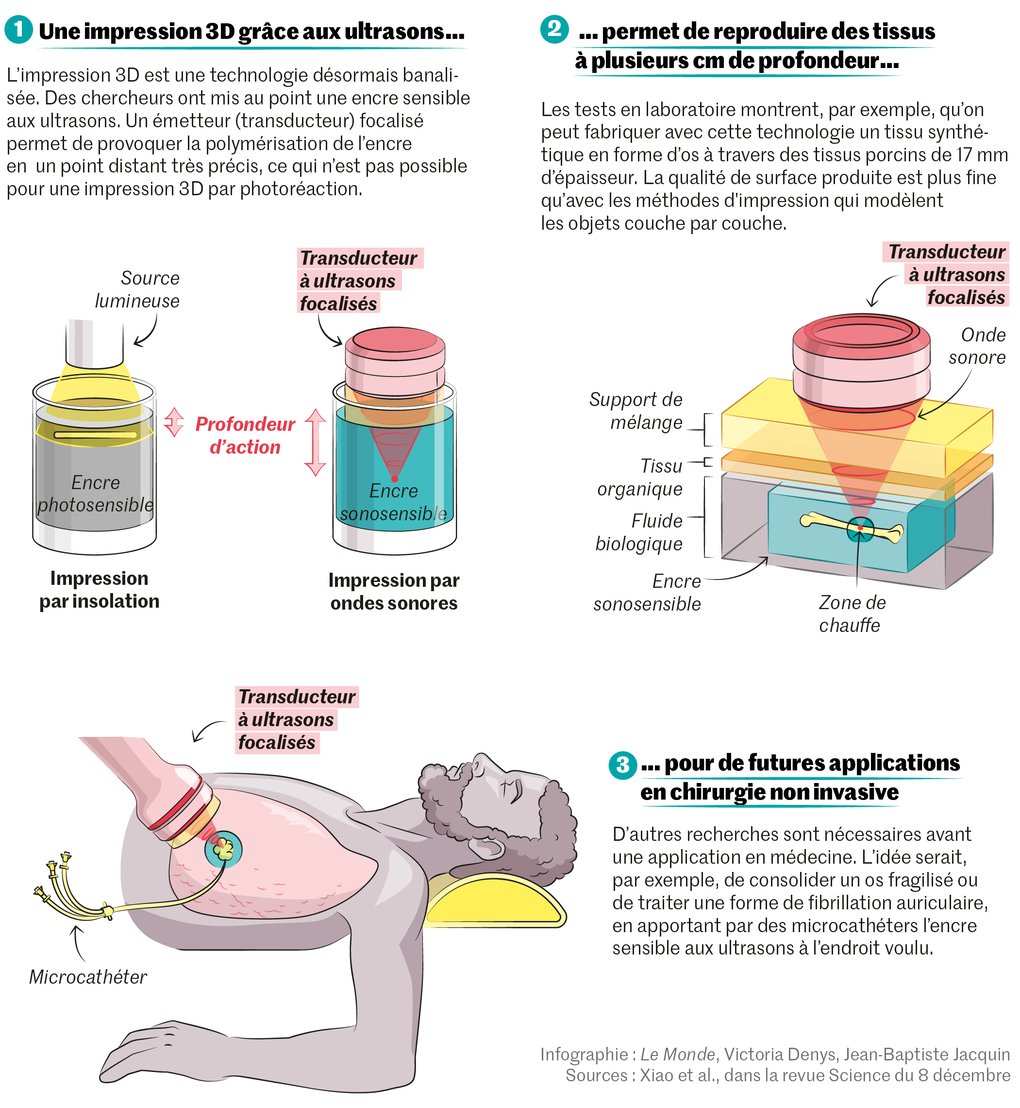 Principe de fonctionnement de l'impression 3D par ultrason pour un usage chez l'Homme