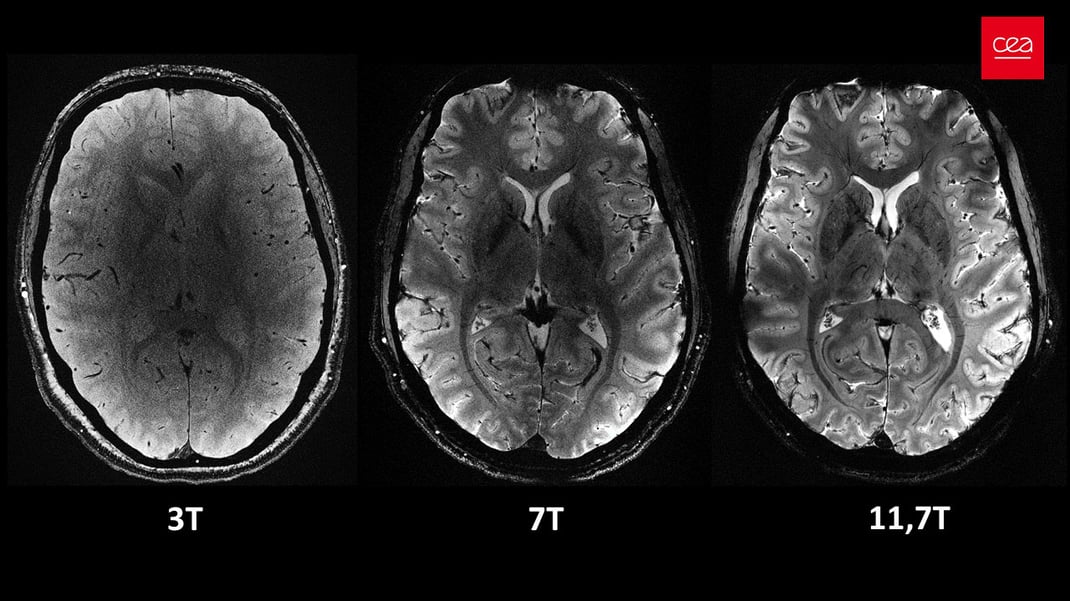Images de cerveau humain en fonction de la puissance du scanner IRM pour un temps d'acquisition similaire (CEA)