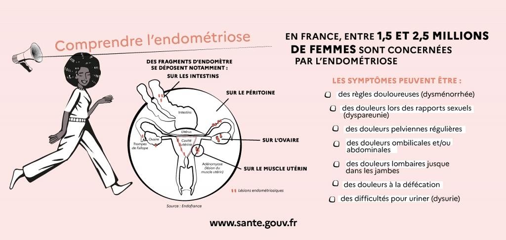 Qu'est-ce que l'endométriose ? (Infographie de santé.gouv.fr)